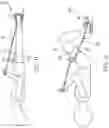 Fig. 09 - Wearable anchor for a therapy device