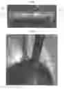 Fig. 10 - Exercise device