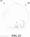 Fig. 24 - Immersive device