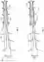 Fig. 03 - APPARATUS AND METHODS FOR FILTERING/COALESCING GAS