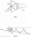 Fig. 06 - APPARATUS AND METHODS FOR FILTERING/COALESCING GAS