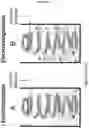 Fig. 15 - Electrosorptive cavitation devices and methods for phase separation