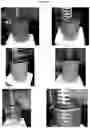 Fig. 17 - Electrosorptive cavitation devices and methods for phase separation