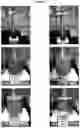 Fig. 28 - Electrosorptive cavitation devices and methods for phase separation