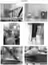 Fig. 38 - Electrosorptive cavitation devices and methods for phase separation