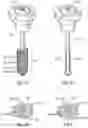 Fig. 09 - Flotation separation device