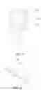 Fig. 03 - Push-button switching shower head structure