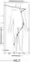 Fig. 06 - Showerhead for consistent shower experiences over a range of inlet pressures