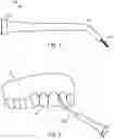 Fig. 08 - DEVICES AND METHODS FOR CLEANING INTERPROXIMAL AREAS