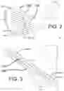Fig. 05 - GOLF CLUB HEAD AND METHOD OF FABRICATION