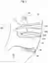 Fig. 08 - Cutting insert and cutting tool