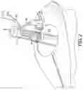 Fig. 03 - Puller spacer