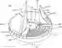 Fig. 01 - Cutting tool for scoring a hose over a fitting