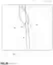 Fig. 05 - METHOD FOR INSTALLING SLIDE FASTENER ASSEMBLY IN THIN SHELL GARMENT