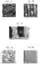 Fig. 04 - Laser-produced porous surface