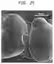 Fig. 24 - Laser-produced porous surface