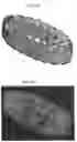 Fig. 46 - Laser-produced porous surface