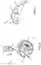 Fig. 06 - Tire having replaceable discrete traction elements