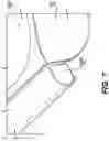 Fig. 07 - WEATHER STRIP TENSIONER