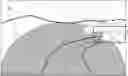 Fig. 01 - Method for operating a headlight of a vehicle, and high beam assist system