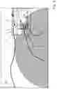 Fig. 04 - Method for operating a headlight of a vehicle, and high beam assist system