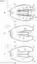 Fig. 09 - Airbag apparatus with protrusion parts
