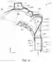 Fig. 05 - Front vehicle body structure of vehicle