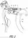 Fig. 03 - Hydraulic operating device