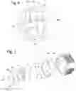 Fig. 04 - Apparatus for sensing movement of an object relative to a fluid