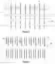 Fig. 03 - Yarn tension and breakage sensor system