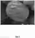 Fig. 06 - Method of Forming Yolk-Shell-Structured Material