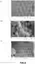 Fig. 04 - Iridium and / or iridium oxide microsphere-based porous material, preparation method therefor, and uses thereof
