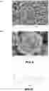 Fig. 06 - Iridium and / or iridium oxide microsphere-based porous material, preparation method therefor, and uses thereof