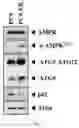 Fig. 02 - Composition for autophagy inhibiting in cell, and pharmaceutical composition for preventing or treating tumor disease, or inhibiting anti-cancer agents resistance containing the same