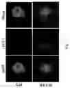Fig. 03 - Composition for autophagy inhibiting in cell, and pharmaceutical composition for preventing or treating tumor disease, or inhibiting anti-cancer agents resistance containing the same
