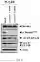 Fig. 06 - Composition for autophagy inhibiting in cell, and pharmaceutical composition for preventing or treating tumor disease, or inhibiting anti-cancer agents resistance containing the same