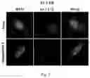 Fig. 07 - Composition for autophagy inhibiting in cell, and pharmaceutical composition for preventing or treating tumor disease, or inhibiting anti-cancer agents resistance containing the same