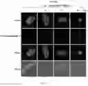 Fig. 09 - Composition for autophagy inhibiting in cell, and pharmaceutical composition for preventing or treating tumor disease, or inhibiting anti-cancer agents resistance containing the same