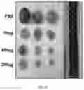 Fig. 12 - Composition for autophagy inhibiting in cell, and pharmaceutical composition for preventing or treating tumor disease, or inhibiting anti-cancer agents resistance containing the same