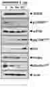 Fig. 13 - Composition for autophagy inhibiting in cell, and pharmaceutical composition for preventing or treating tumor disease, or inhibiting anti-cancer agents resistance containing the same