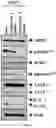 Fig. 14 - Composition for autophagy inhibiting in cell, and pharmaceutical composition for preventing or treating tumor disease, or inhibiting anti-cancer agents resistance containing the same