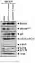Fig. 17 - Composition for autophagy inhibiting in cell, and pharmaceutical composition for preventing or treating tumor disease, or inhibiting anti-cancer agents resistance containing the same