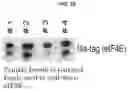 Fig. 28 - Modulation of P53 for the treatment of cancer
