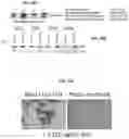 Fig. 44 - Modulation of P53 for the treatment of cancer