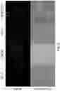 Fig. 11 - Prostate-specific membrane antigen (PSMA) targeting peptides