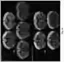 Fig. 54 - Engineered light-sensitive proteins