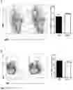 Fig. 20 - IDENTIFICATION OF A NOVEL B CELL CYTOKINE