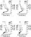 Fig. 07 - Glucose responsive insulin comprising a tri-valent sugar cluster for treatment of diabetes