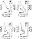 Fig. 09 - Glucose responsive insulin comprising a tri-valent sugar cluster for treatment of diabetes