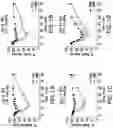 Fig. 13 - Glucose responsive insulin comprising a tri-valent sugar cluster for treatment of diabetes